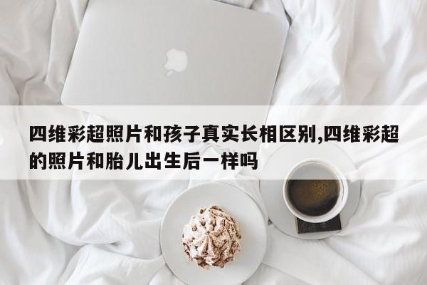 四维彩超照片和孩子真实长相区别,四维彩超的照片和胎儿出生后一样吗
